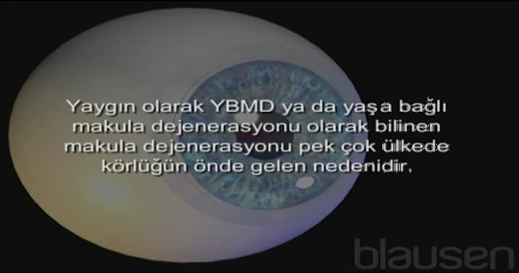 Makula Dejenerasyonu-YBMD